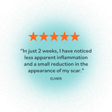 Derma E, Scar Gel, 2 Oz
