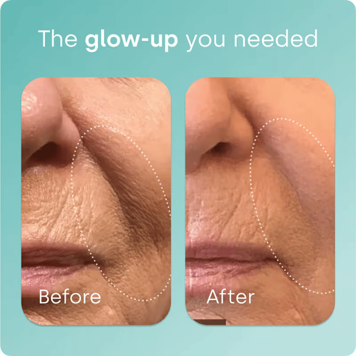 Biosil, Advanced Collagen Generator® Original, 120 Capsules